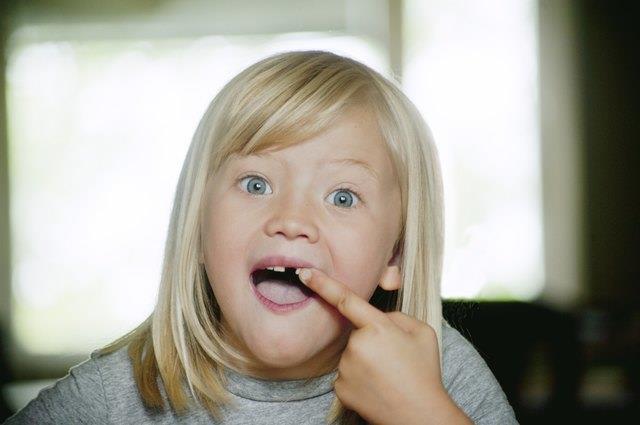 Welche Milchzähne verlieren Kinder? Welche Milchzähne verlieren Kinder?